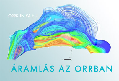 ORR ARAMLAS LEGZES